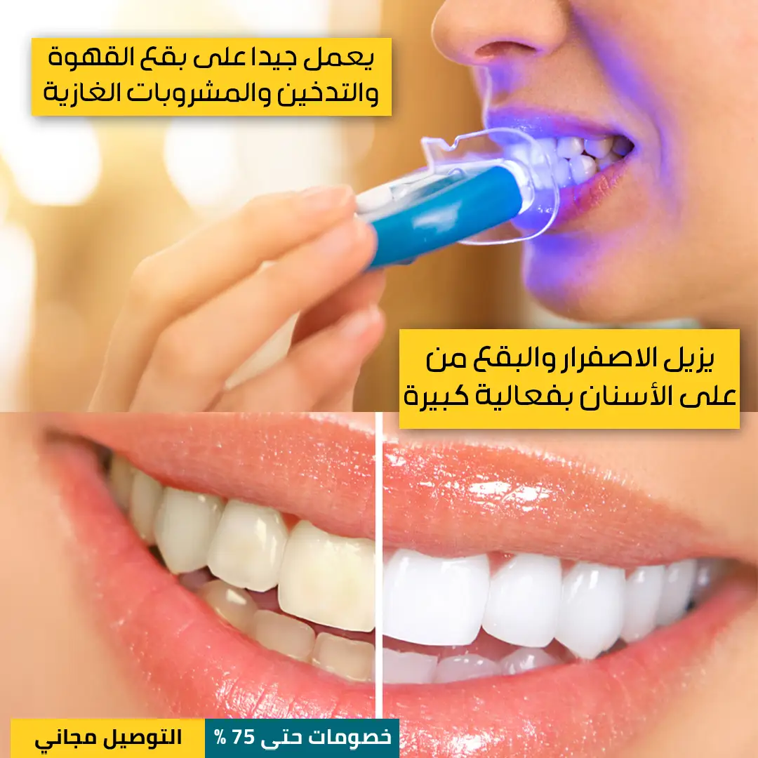 جهاز-تبييض-الأسنان-بالليزر-2.webp