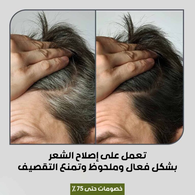 صبغة الشعر الكورية (3)