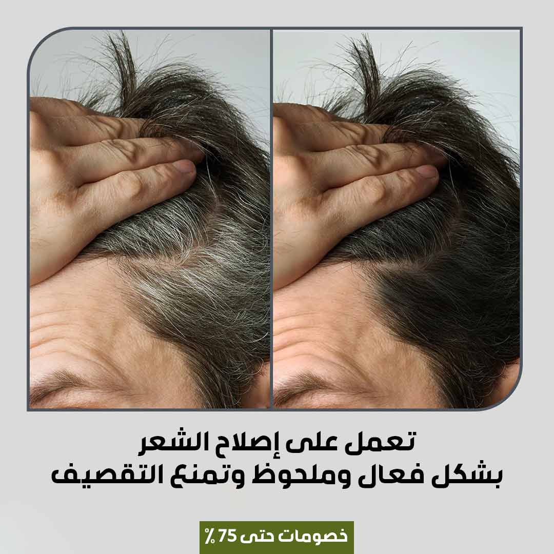 صبغة الشعر الكورية (3)