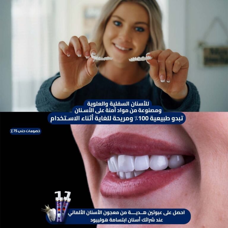 Hollywood Smile Teeth 2