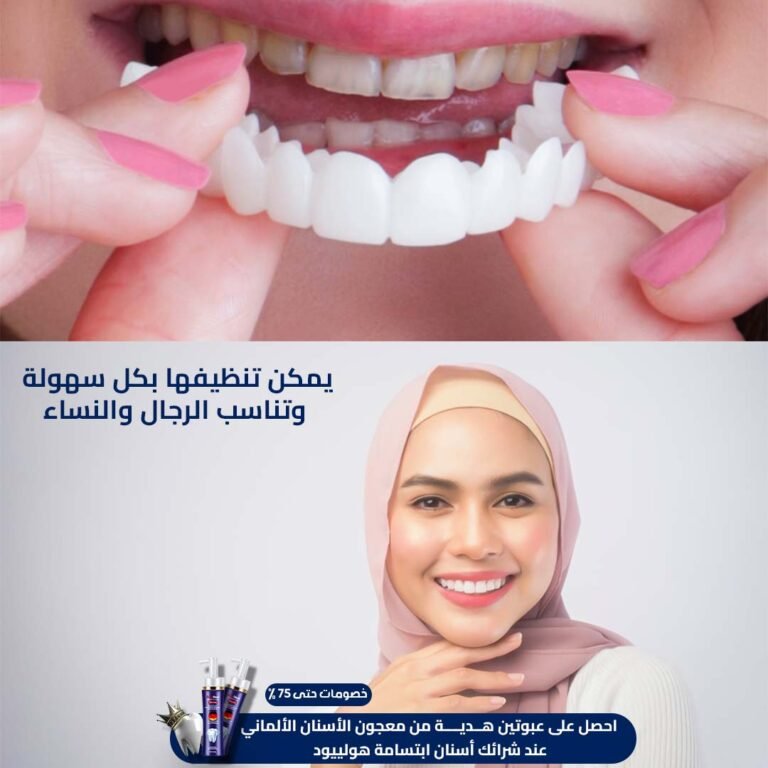 Hollywood Smile Teeth 3